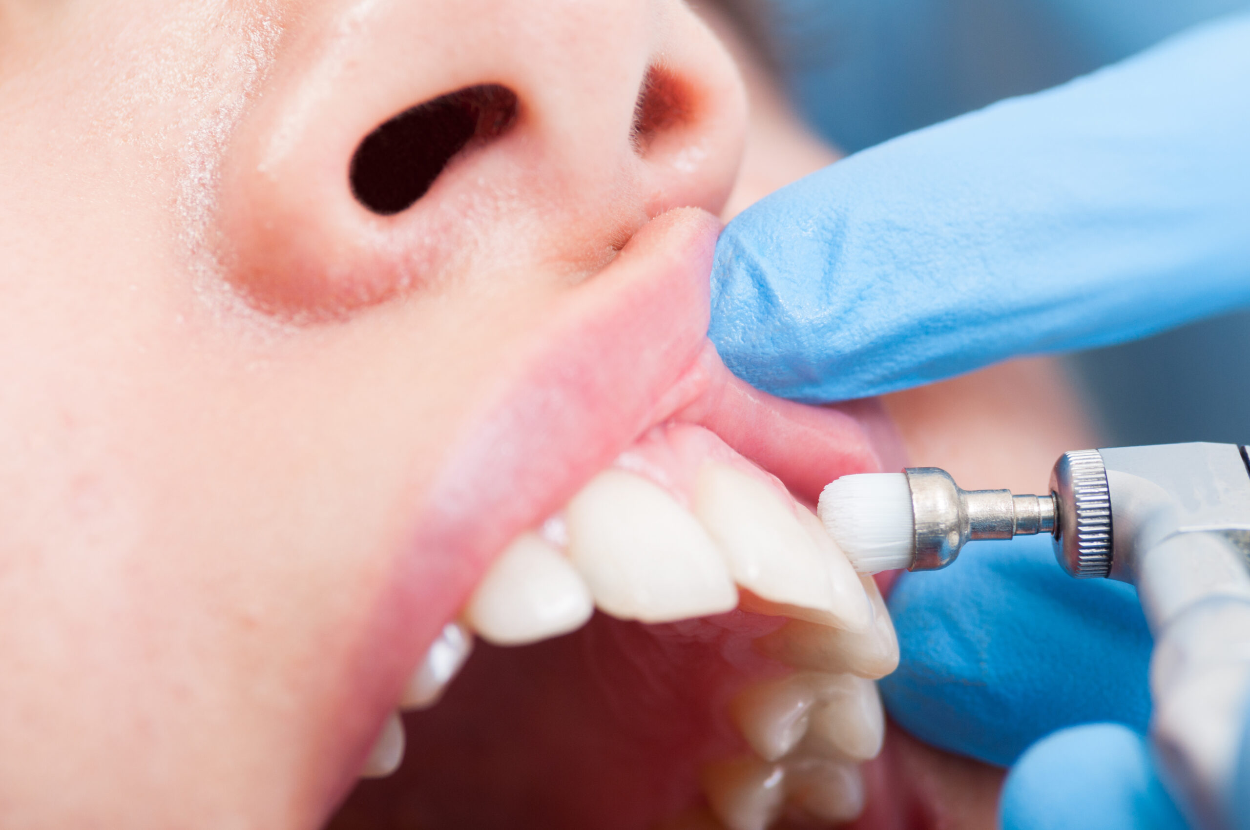 Prophylaxe ist die Basis der Zahngesundheit. Foto: Adobe Stock / Catalin Pop